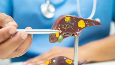 About 84% IT Employees Are Suffering With Fatty Liver Disease - Why Screenings Are Necessary For Corporate Workers
