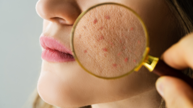 How To Tell Your Skin Barrier Is Damaged? Step-By-Step Guide To Rebuilding Your Skin’s Defenses