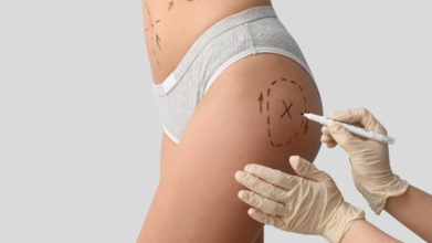 No More BBL For Non-Medics, UK to Regulate High-Risk Beauty Procedures