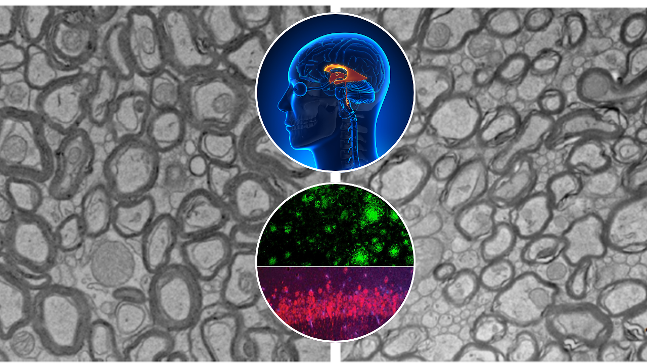 Could Lithium Deficiency In The Brain Trigger Alzheimer’s? | Health and Me