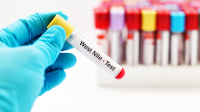 First West Nile Virus Case Confirmed In Michigan - What Is West Nile And Who Is At Risk?