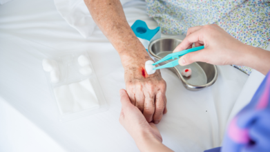 What Kind Of Wipes Should You Use To Clean Wounds? Here's What UKHSA Suggests