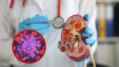 Chronic Kidney Disease Could Be Predicted With The Help Of Biological Markers - Research Finds