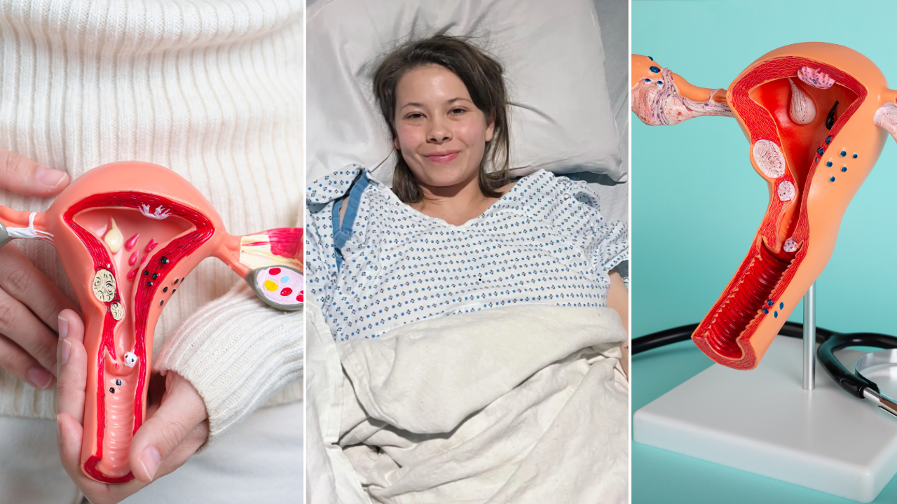 The Endometriosis Battle Finally Comes To An End For Bindi Irwin, As