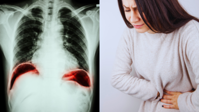 Symptoms of Peptic Ulcer