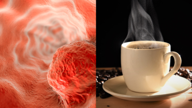 Hot Drinks and Oesophageal Cancer