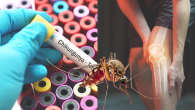 Chikungunya