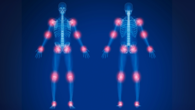 Japanese Scientists Discover Hidden Immune 'Hubs' That Could Cause Arthritis-Related Joint Damage