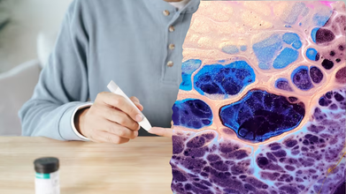 Man With Diabetes Produces Own Insulin After World’s First Gene-Edited Cell Transplant