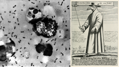 Bubonic Plague California Resident: Here's All That You Need To Know About The Disease