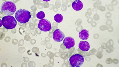 New Stem Cell Transplant Breakthrough Could Replace Chemo In Cancer Treatment