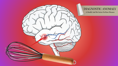 Diagnostic Anomaly: Woman Dies During Orgasm After Rare Aneurysm Ruptures In The Brain