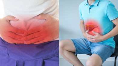 Hernia