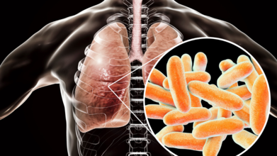 Legionnaires' Outbreak Update: It Is No Longer 'Only A New York Problem'