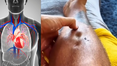 The Bizarre Foot Test That Could Point Towards A Heart Failure