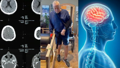 Ohio Man Walks Again After Stroke, Thanks To New Implant Technology