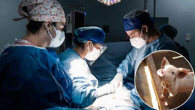 Human Pig Lung Transplant: First-Ever Gene-Edited Pig Lung Transplanted Into a Brain-Dead Man Successfully
