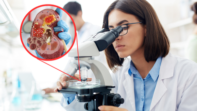Israeli Scientists Created The First Lab-Grown Kidney That Survived 34 Weeks