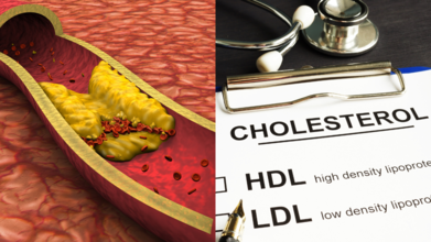 Lower Your Cholesterol