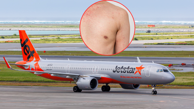 Measles Alert Issued In Brisbane After Traveller Returning From Bali Tests Positive