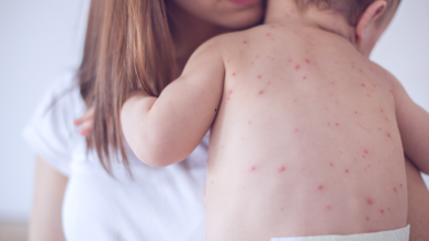 Indonesia Launches Mass Vaccination Drive After Deadly Measles Outbreak