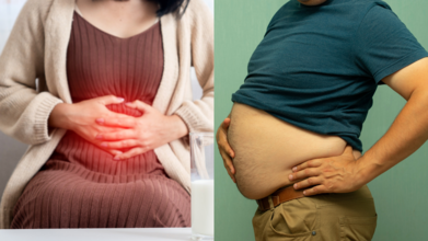 Bloating