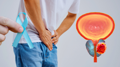 Prostate Cancer