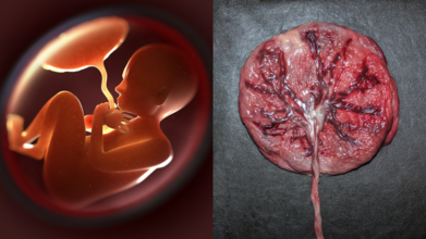 Placenta Preservation
