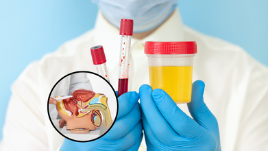 Prostate Cancer Can Now Be Detected Through These Identifiers In A Non-Invasive Urine Test