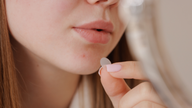 Dream Come True! New Pimple Patch May Clear Your Acne In Just 7 Days