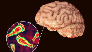 Brain Eating Amoeba Cases Surge In Kerala
