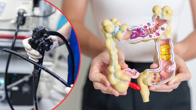Simple Stool Test Can Reveal Colorectal Cancer With 90% Accuracy: Could This New Study Could End Colonoscopy?
