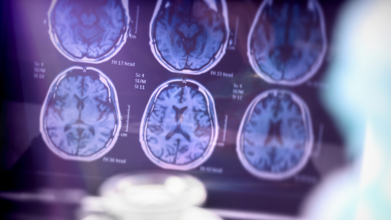 India Gets Its First Non-Invasive FDA-Approved Test for Alzheimer’s Detection, Here's All You Need To Know