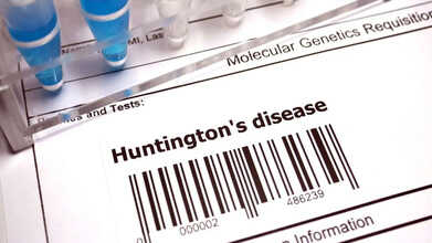 Huntington’s Disease Gets First Successful Treatment