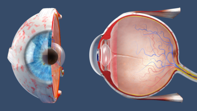 This Is Why Diabetic Patients Must Get Their Eye Screened Annually, According To Eye Doctors