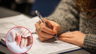 'If You See This On Your Nails, Go To The Doctor Immediately' Podiatric Warns About Symptom That Indicates Leaky Heart