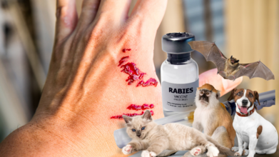 Doctors Answer The Most Googled Rabies-Related Questions For You