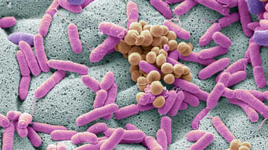 walmart recall listeria