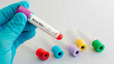 west nile virus in us