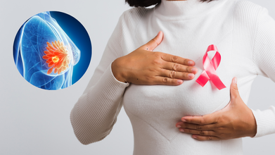 Can Wearing Black Undergarments Cause Breast Cancer? Expert Busts Breast Cancer-Related Myths
