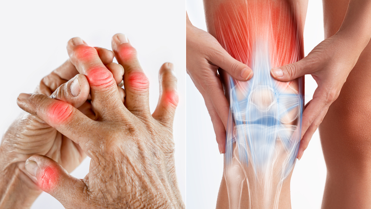 New Developments Like Lower Doses of Radiation And Drug-filled Cartilage Could Help In Arthritis Treatment