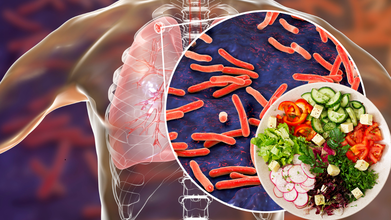 WHO’s Latest TB Guidelines Highlight Nutrition as Key to Treatment