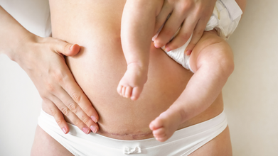 C-Section Births Can Lead To Sleep Problems And Severe Pain: Study