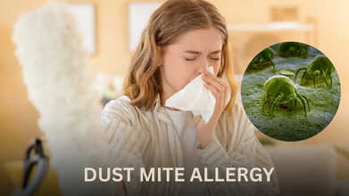 DUST MITE ALLERGY