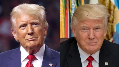 Is US President Donald Trump Getting A Double Hip Replacement Surgery?