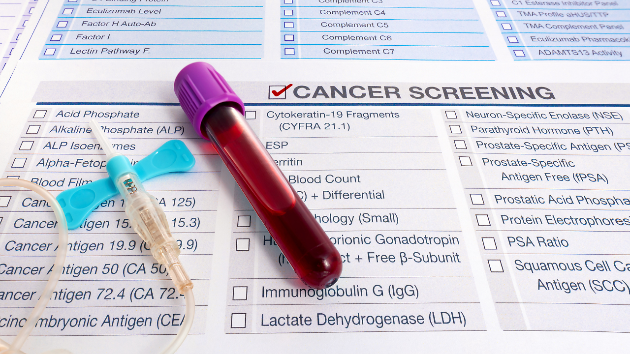 Simple Blood Test Could Reveal 50 Types Of Cancer Years Before Symptoms ...