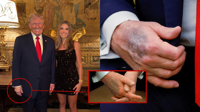 Kai Trump’s New Instagram Post Sparks Questions About Donald Trump’s Health And His Mysterious Hand Bruise