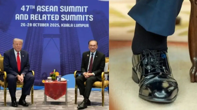 Donald Trump Health Update: First Hand Bruise, Now Swollen Ankle, Is The President Hiding A Health Crisis?