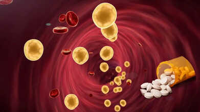 cholesterol reduction statin