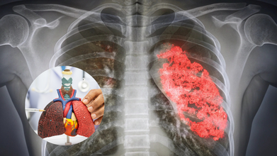 World Pneumonia Day 2025: Theme, Origin, Significance